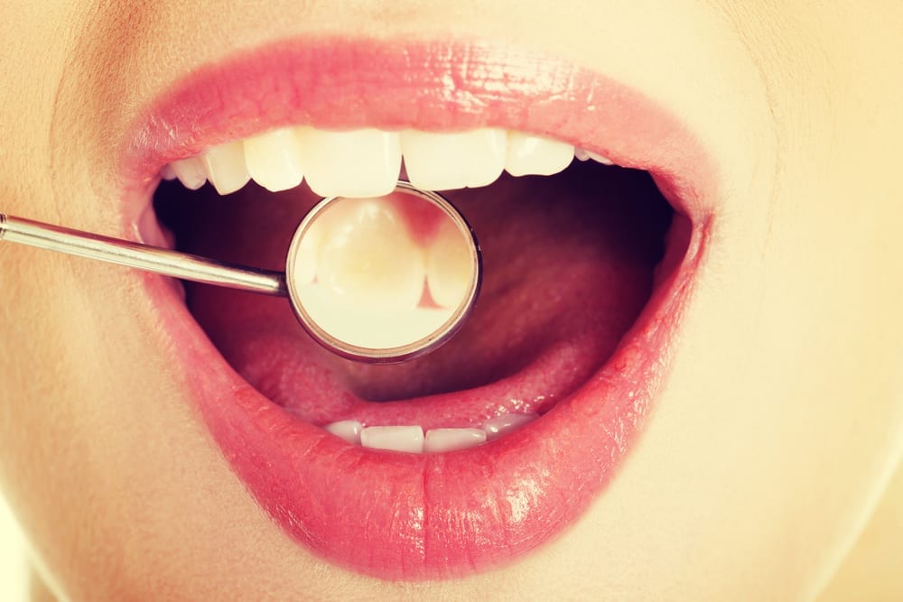 Importance of regular dental examas