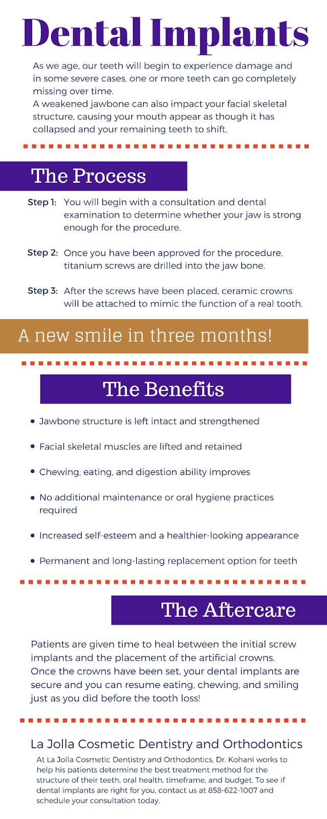 Dental Implant Infographic 2-12-18