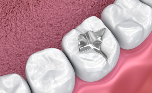 medically accurate 3D illustration - illustration-img-blog