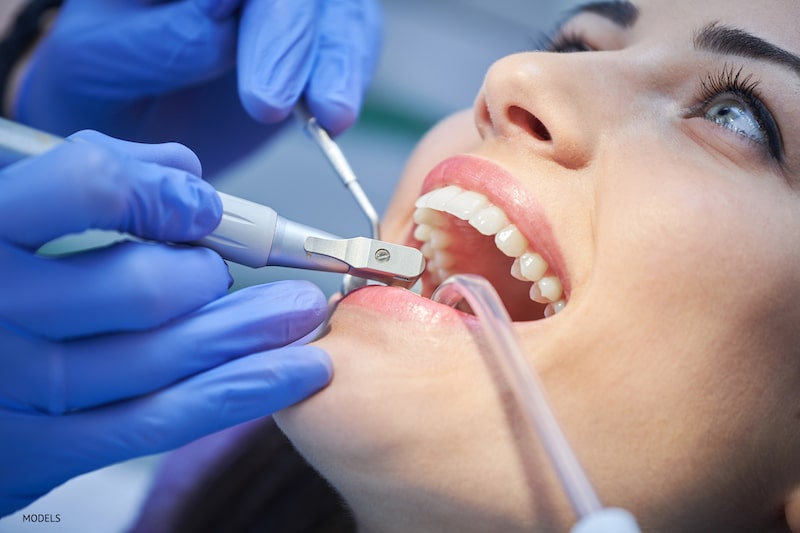 Why Are Dental Cleanings So Important to Your Overall Health?
