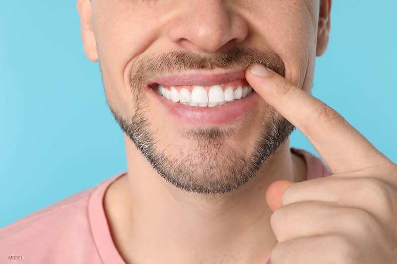 How Fast Can My Teeth Be Straightened?  La Jolla Cosmetic Dentistry &  Orthodontics